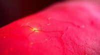 red light improves skin circulation
