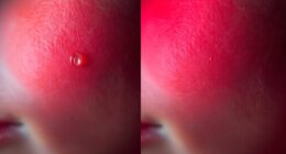 skin moisture and light