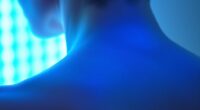 using blue light therapy