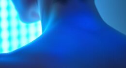 using blue light therapy
