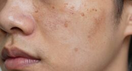 avoid darkening skin