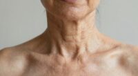 neck and chest aging