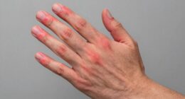 optimal red light placement