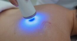 optimal timing for scar therapy