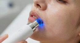 using high frequency wands properly