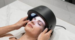 4 Best Light Therapy Devices for Rosacea Prone Skin in 2026