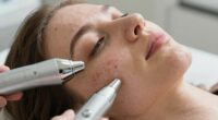 comprehensive facial acne solutions