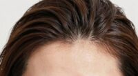 different expectations for scalp