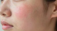 gentle skincare device approach
